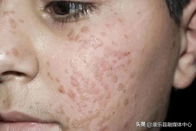 第424页